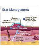 Biodermis Epi-Derm Silicone Gel C-Strip 1.25"x5.75" - Clear Gel (1 Strip per Package)-3