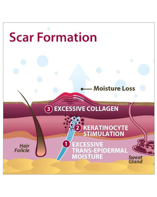 Biodermis Epi-Derm Epi-Tabs Circle .75"x.75" - Clear Gel 30 per Package)