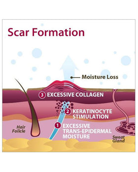 Biodermis Epi-Derm Silicone Gel Large Sheet 15.5"x11" - Clear Gel (1 Sheet per Package) - 0