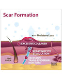 Biodermis Epi-Derm Silicone Gel Long Strip 1.4"x11.5" - Clear Gel (1 Pair per Package)-2