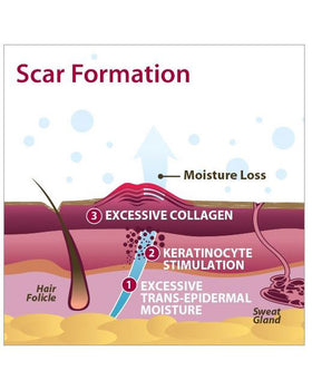 Biodermis Epi-Derm Silicone Gel Long Strip 1.4"x11.5" - Clear Gel (5 Pair per Package) - 0