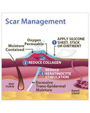 Biodermis Epi-Derm Silicone Gel Long Strip 1.4"x11.5" - Clear Gel (5 Pair per Package)-3