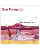 Biodermis Epi-Derm Silicone Gel Patch 2"x2.5" - Clear Gel (5 Pair per Package)-2