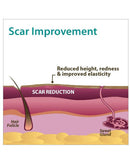 Biodermis Epi-Derm Silicone Gel Patch 2"x2.5" - Clear Gel (5 Pair per Package)-4