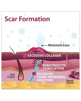 Biodermis Epi-Derm Silicone Gel Standard Sheet 4.7" x 5.7" - Clear Gel - 1 sheet per package - 0