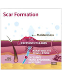 Biodermis Xeragel Silicone Scar Ointment 10gm - 1 each-3