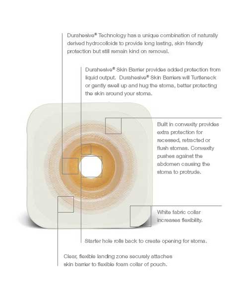 Convatec Esteem Synergy Convex Durahesive Moldable Skin Barrier - 10 per box, 33MM - 45MM (1-1/4" TO 1-3/4"), ORANGE - WITH TAPE - 0